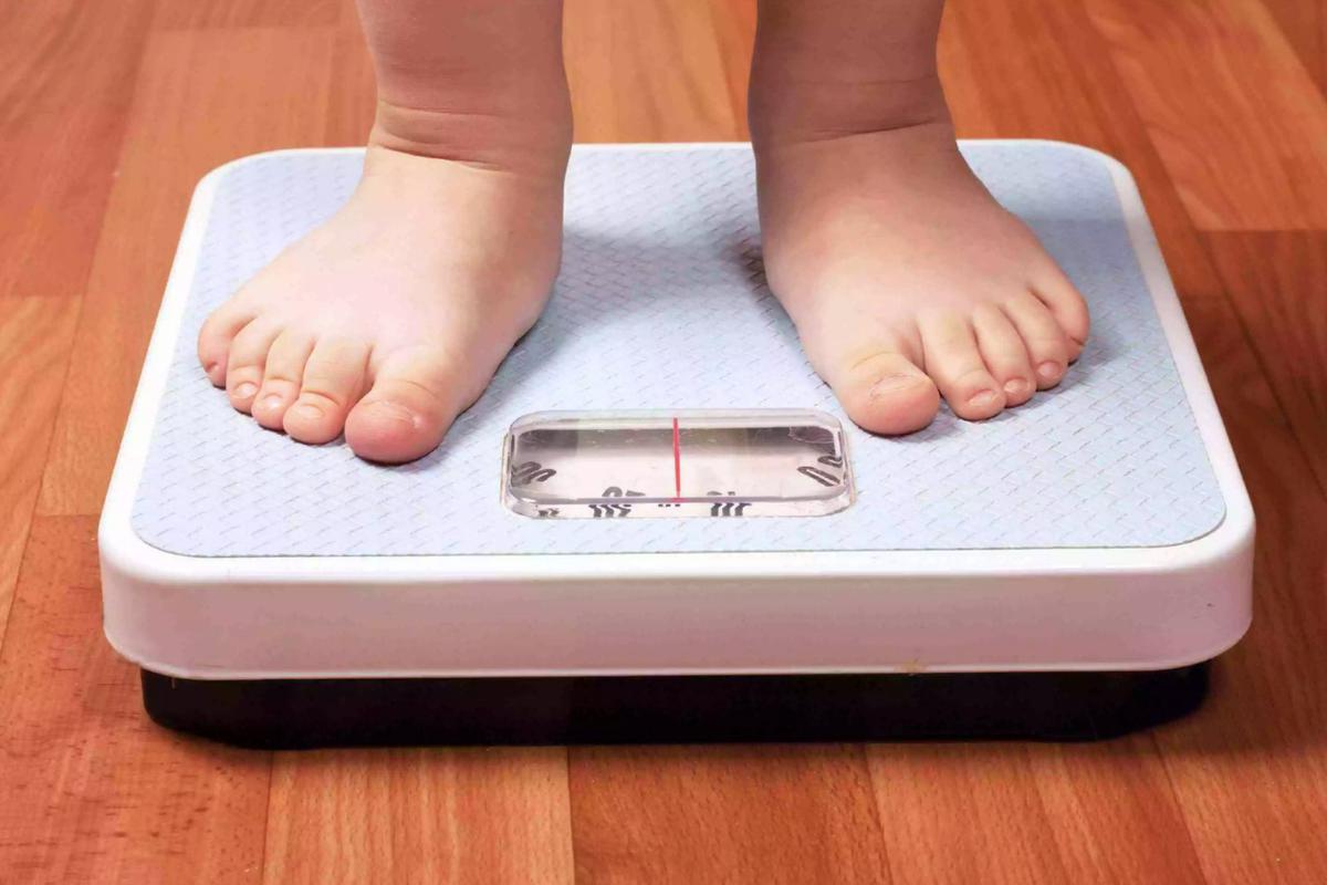 obesidad infantil