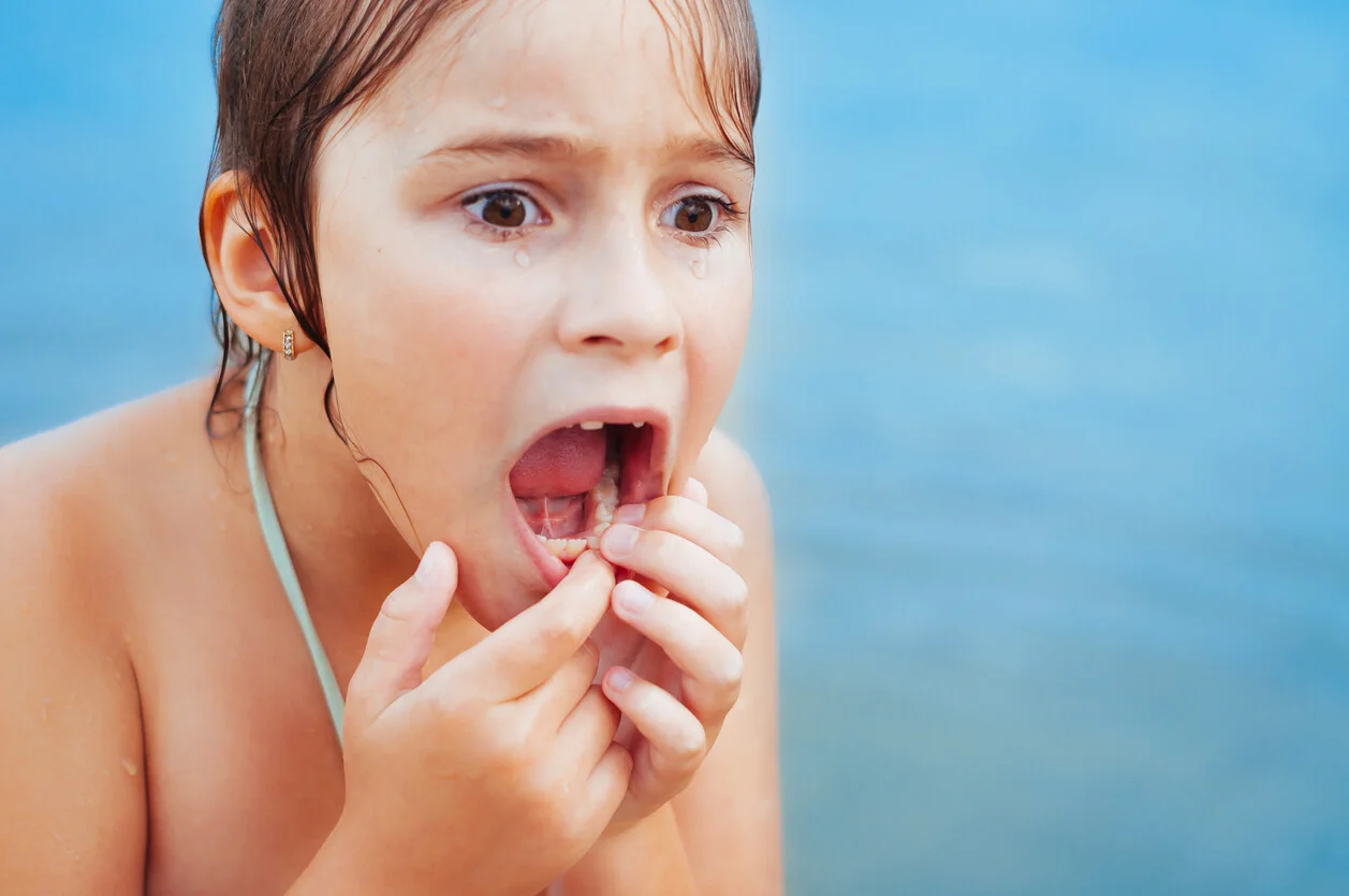 golpes en dientes de leche