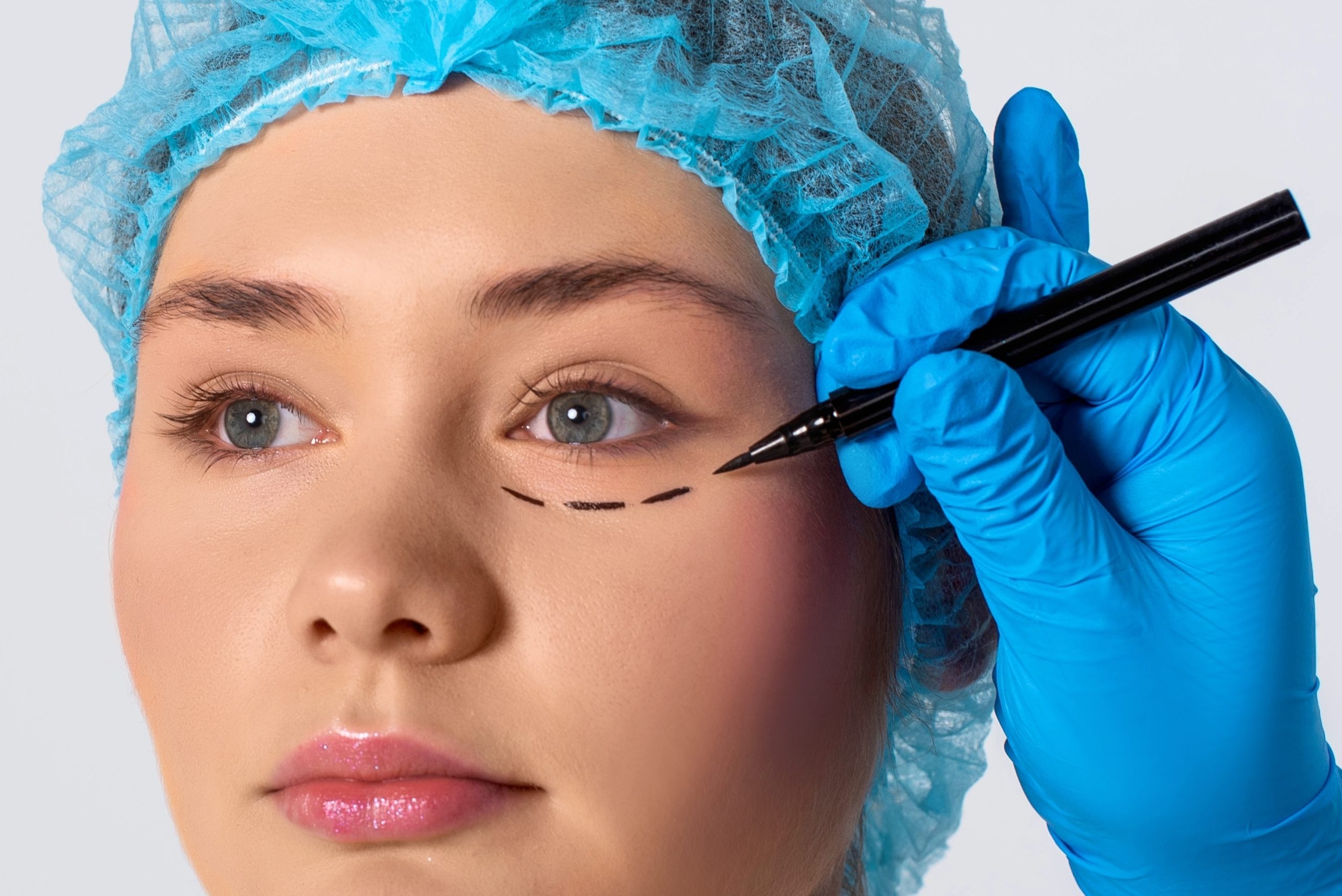 adolescente con cirugía estética