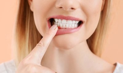 los dientes envejecen